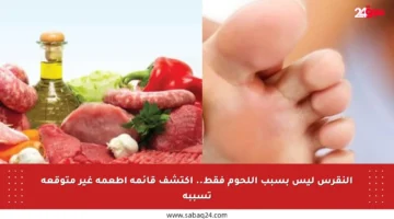 النقرس ليس بسبب اللحوم فقط.. اكتشف قائمة أطعمة غير متوقعة تسببه
